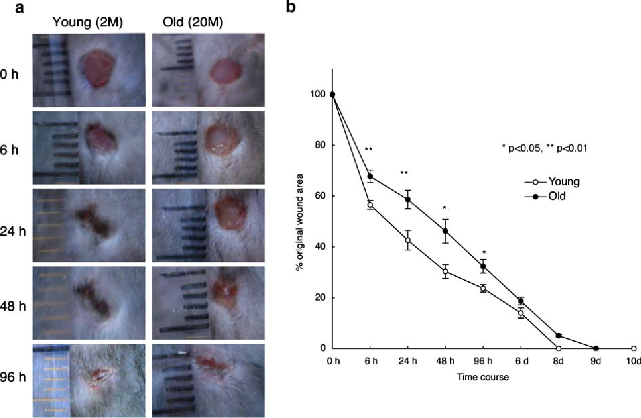 Up-regulation of Gr1 + CD11b + cell population in the spleen of NaClO-administered mice works to repair skin wounds